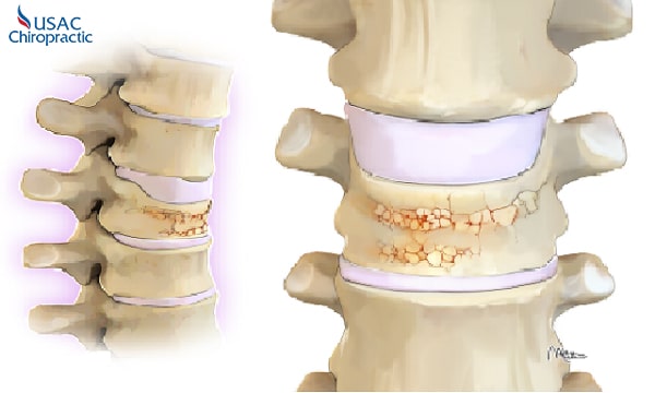 cao ngựa bạch có tác dụng gì